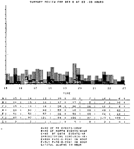 Пример суммарной сводки по пациенту — обычно использовался этот режим, потому что в непрерывном режиме выводилось слишком большой объем данных