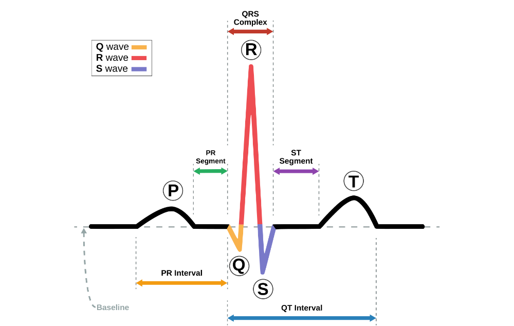 Нормальная картина сердечных сокращений, без аномалий