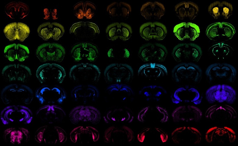 &laquo;Google для мозга&raquo;: учёным открыли единую ИИ?систему для сравнения неврологических заболеваний