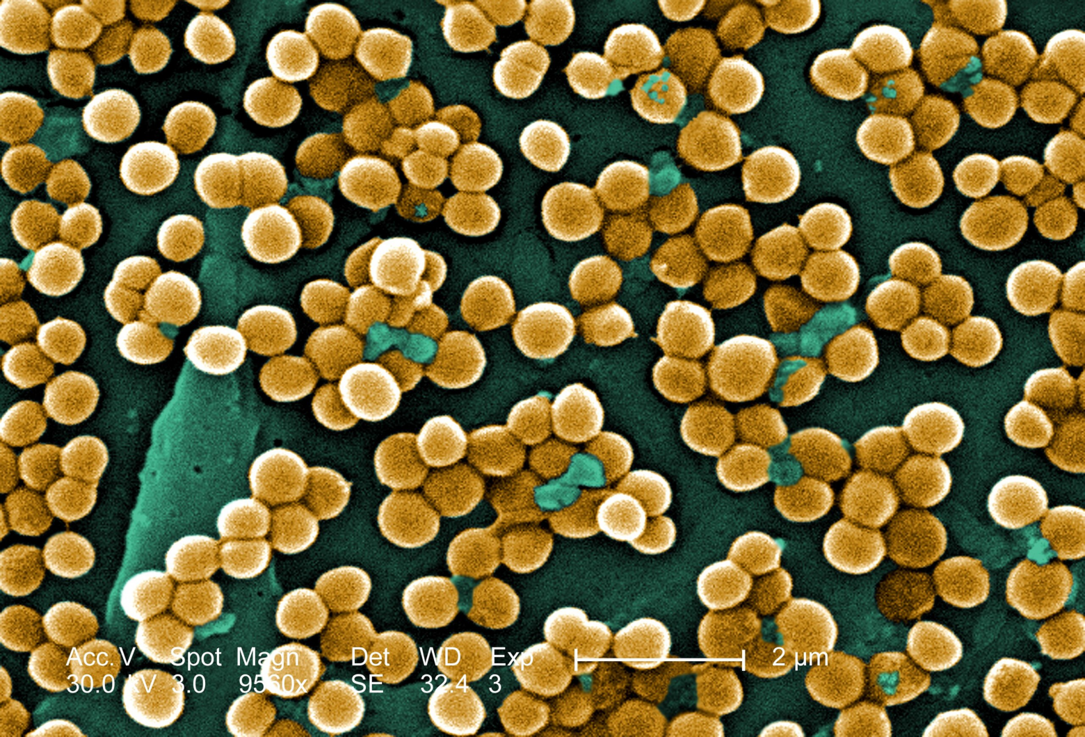 Staphylococcus aureus. Этот красавчик знает, как правильно заставить вас чесаться