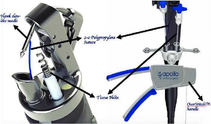 Так выглядит современный вариант