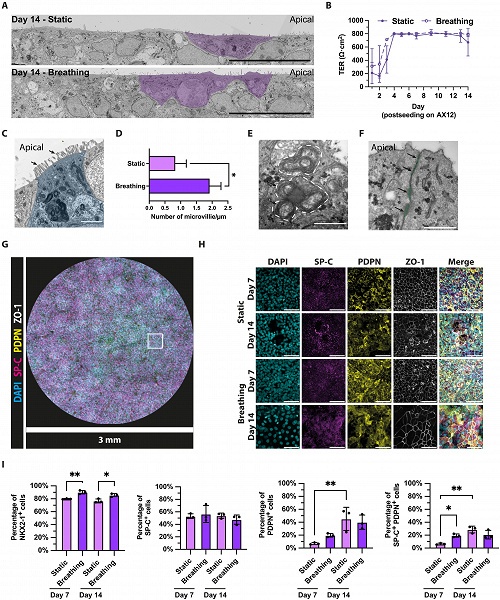 Создана первая дышащая модель «лёгкое-на-чипе» на основе клеток одного человека - 2 Создана первая дышащая модель «лёгкое-на-чипе» на основе клеток одного человека
