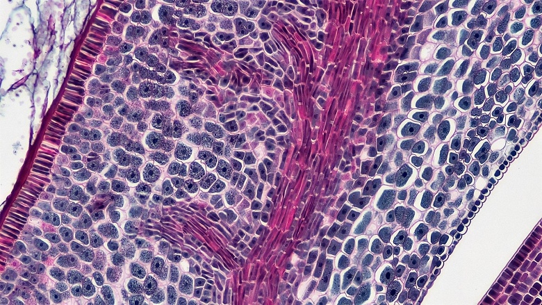 Анализ одной клетки: квантовые методы могут справиться с огромными и &laquo;зашумлёнными&raquo; наборами данных по отдельным клеткам, недоступными для классических методов