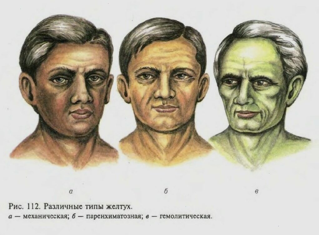 Настороженность массажиста: когда сеанс начинается еще до первого массажного приема. Клинические ориентиры (ч. 2) - 12