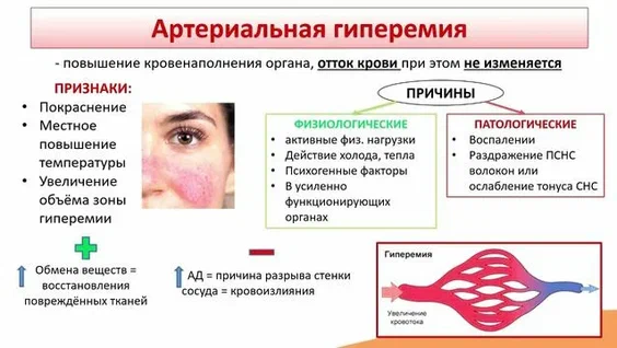 Настороженность массажиста: когда сеанс начинается еще до первого массажного приема. Клинические ориентиры (ч. 2) - 7