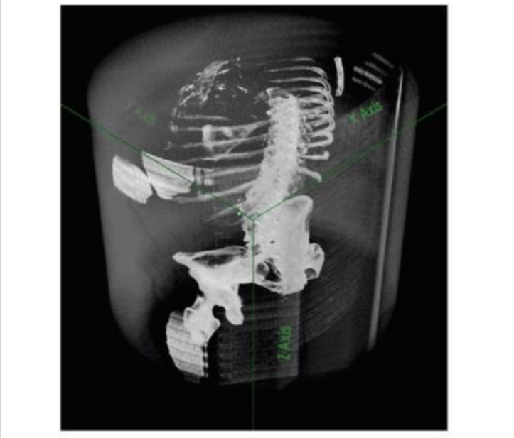 Анализ медицинских изображений: патентный аспект - 3