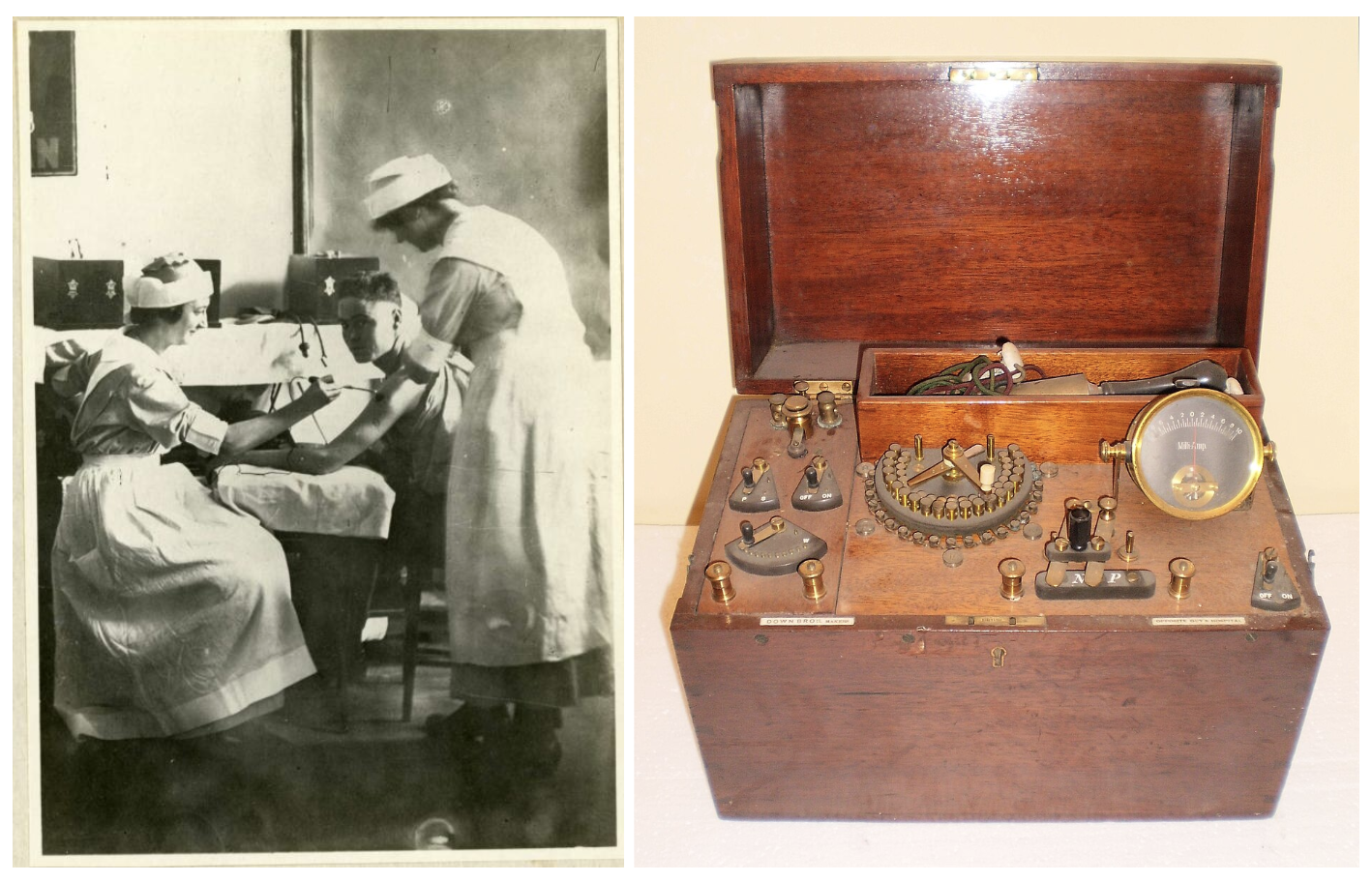 Слева — лечение дельтовидной мышцы, 1940-е годы. Справа — электротерапевтический аппарат начала XX века