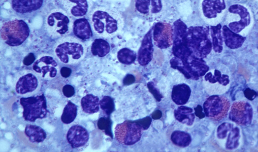  Различные типы клеток имеют разную способность к выживанию, в том числе и лейкоциты