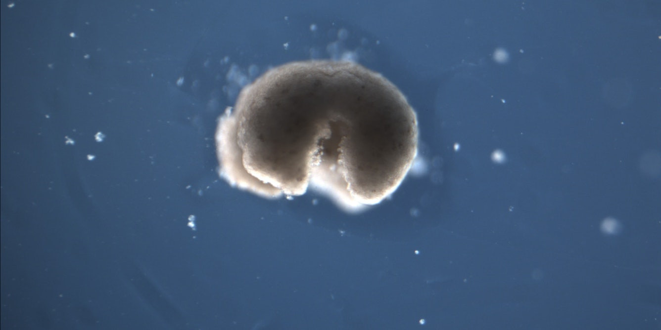 Биоботы возникают из клеток мёртвых организмов, раздвигая границы жизни, смерти и медицины - 1 Биоботы возникают из клеток мёртвых организмов, раздвигая границы жизни, смерти и медицины - 1