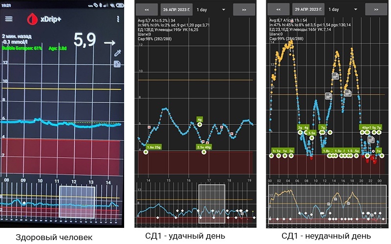 О регуляции сахара в крови - 10 Регуляция сахара в крови - 10