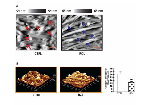 Вот так ретинол разглаживает пучки коллагена и делает кожу упругой Вот так ретинол разглаживает пучки коллагена и делает кожу упругой
