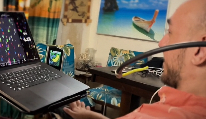 Илон Маск: люди уже управляют компьютерами силой мысли, в испытании Neuralink участвуют 21 человек