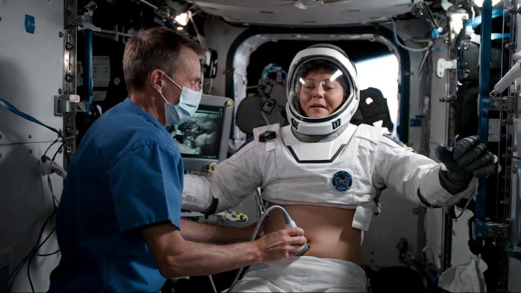 Что происходит с ЖКТ в невесомости: на МКС провели необычный медицинский эксперимент - 1