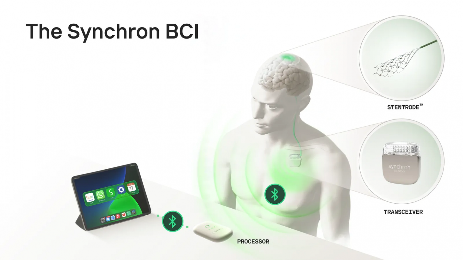 Последнее поколение интерфейса от Synchron