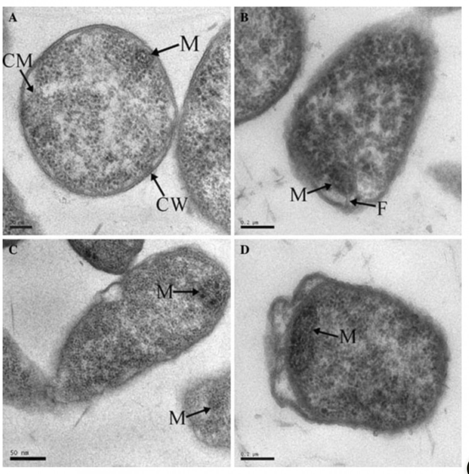 Образование мезосом под воздействием рифампицина (антибиотик) у Xanthomonas campestris.  