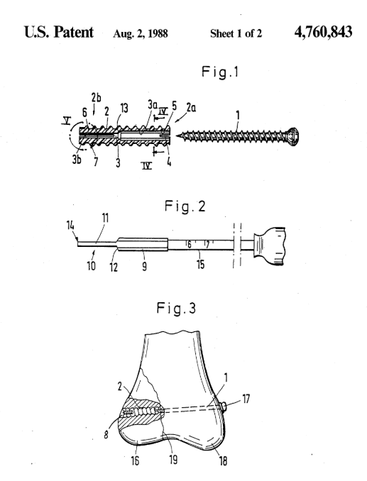 Схема из патента US4760843A