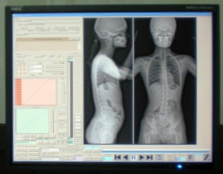 DICOM — Какая печать нужна медицине?