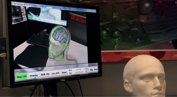Kinect Fusion может помочь хирургам