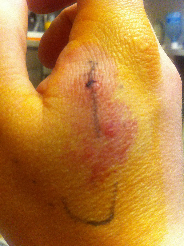 RFID имплантация — результаты через 7 месяцев image