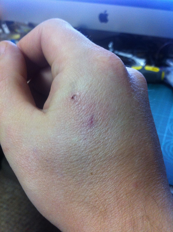 RFID имплантация — результаты через 7 месяцев image