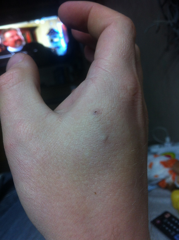 RFID имплантация — результаты через 7 месяцев image