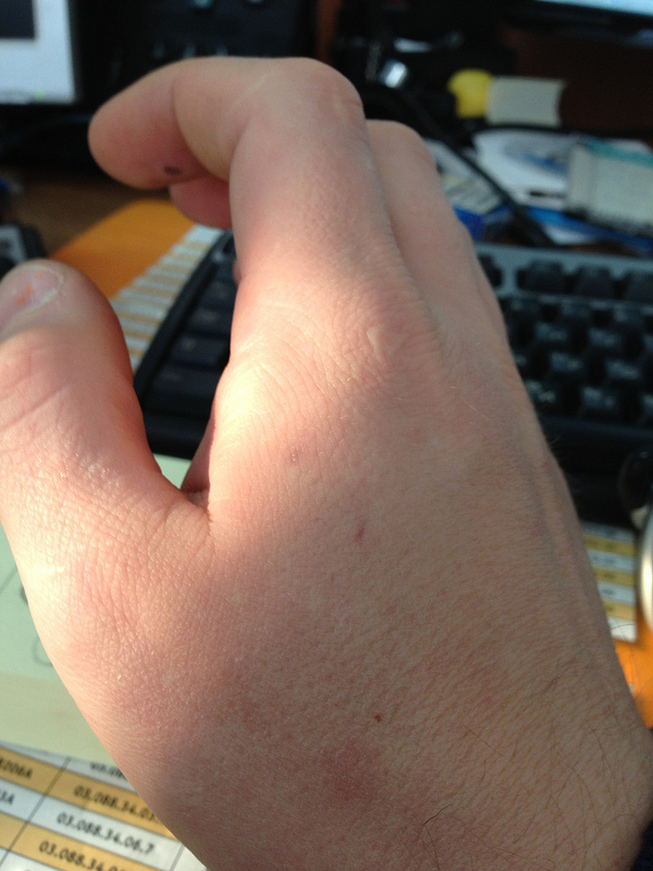 RFID имплантация — результаты через 7 месяцев image