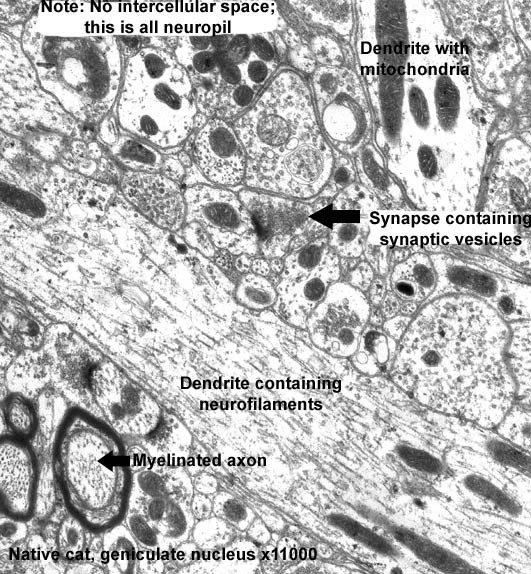 The Human Brain Project: откуда мы знаем, как устроен мозг? The Human Brain Project: откуда мы знаем, как устроен мозг?