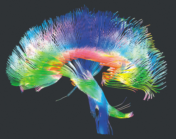 The Human Brain Project: Вы спрашивали – мы отвечаем