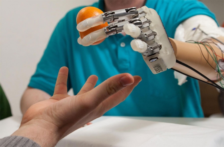 Бионический протез руки возвращает ощущение прикосновения