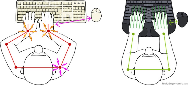 Боремся с RSI — обзор клавиатуры Truly Ergonomic 209
