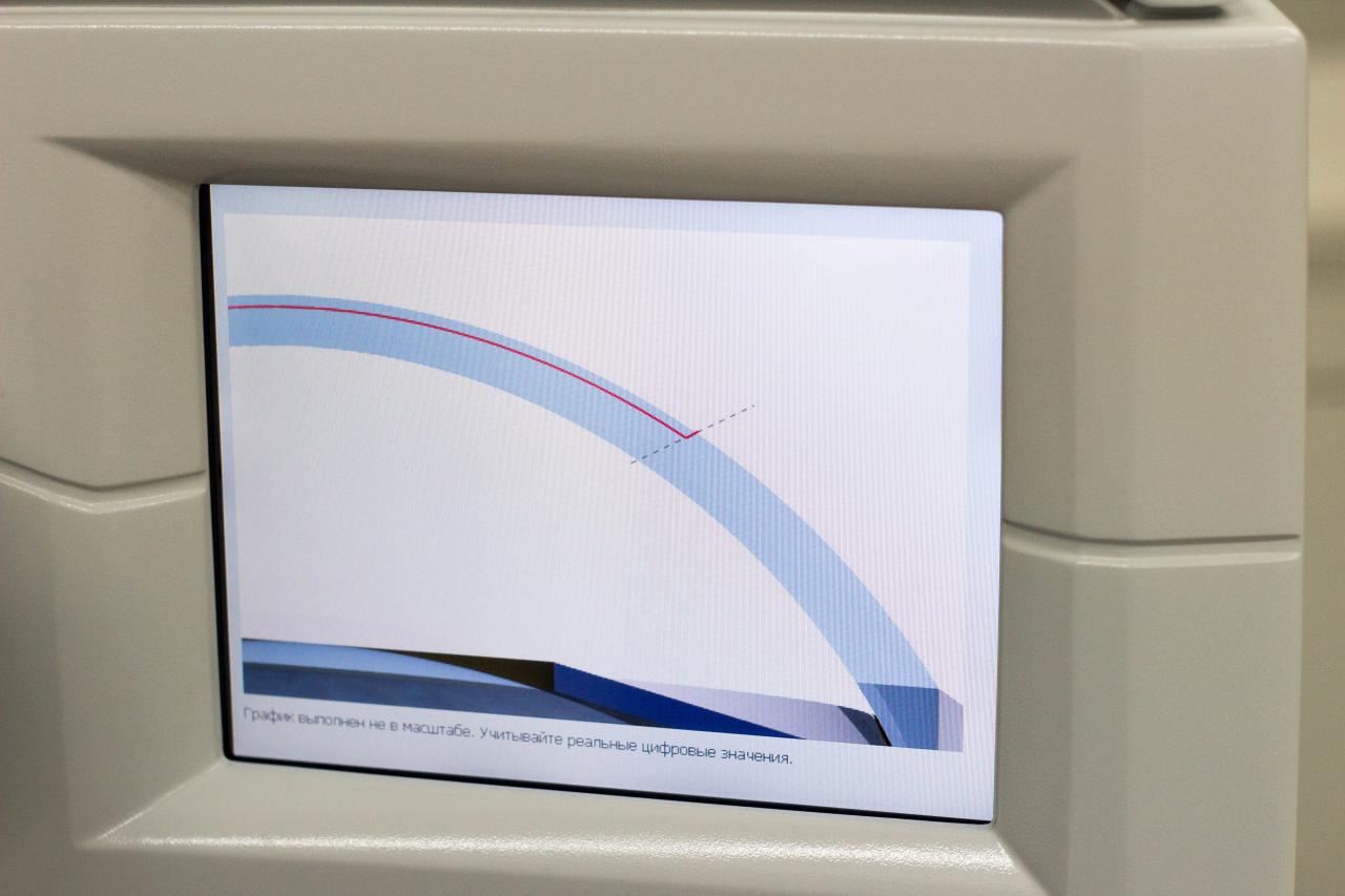 Часть 3. Знакомьтесь — лазер по имени Amaris. Переезды и первое пробуждение VisuMax