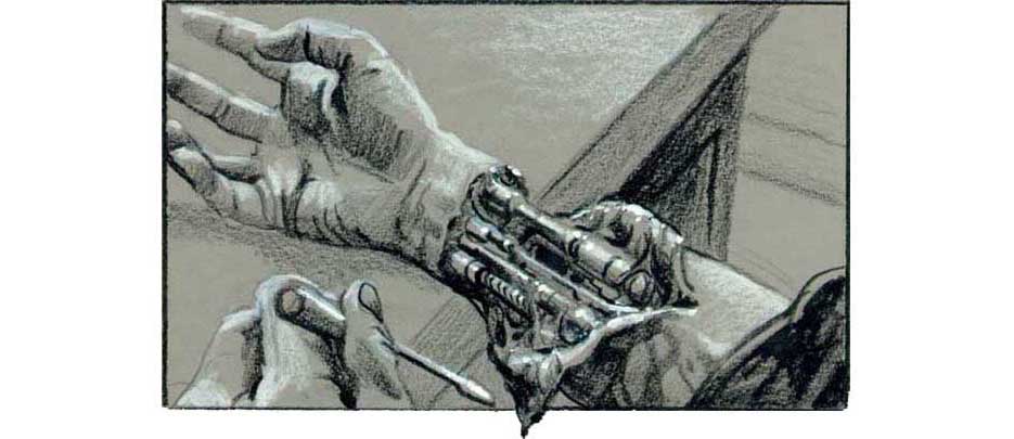 Чудо протез из Голландии image