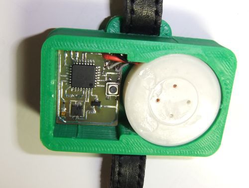 Детектор приступа эпилепсии своими руками Детектор приступа эпилепсии своими руками