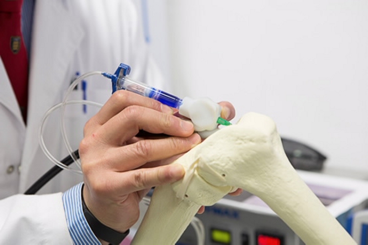Хирургический 3D принтер BioPen позволяет «печатать» ткани прямо в ходе операции