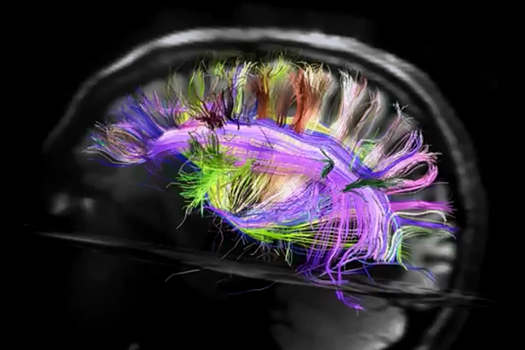 Логика мышления. Часть 1. Нейрон Логика мышления. Часть 1. Нейрон