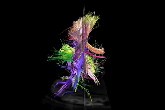 Логика мышления. Часть 1. Нейрон Логика мышления. Часть 1. Нейрон