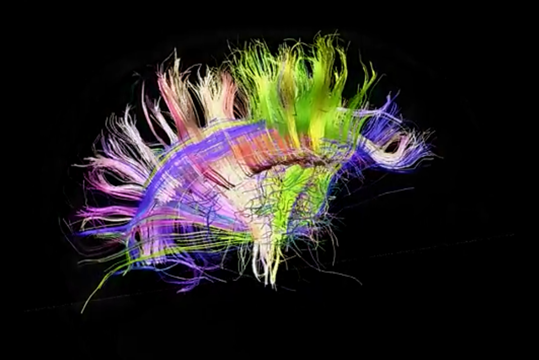 Логика мышления. Часть 1. Нейрон Логика мышления. Часть 1. Нейрон
