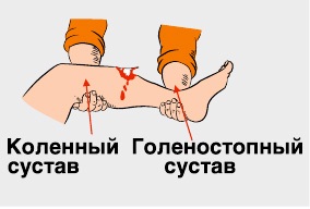 Оффтопик! Основы первой помощи. Помочь и не навредить