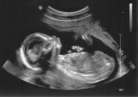 Опасна ли комета ISON? Опасна ли комета ISON?