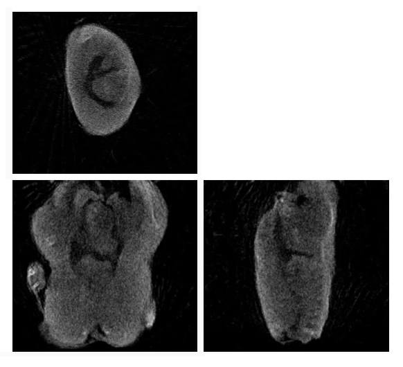 Самодельный рентгеновский компьютерный томограф Самодельный рентгеновский компьютерный томограф