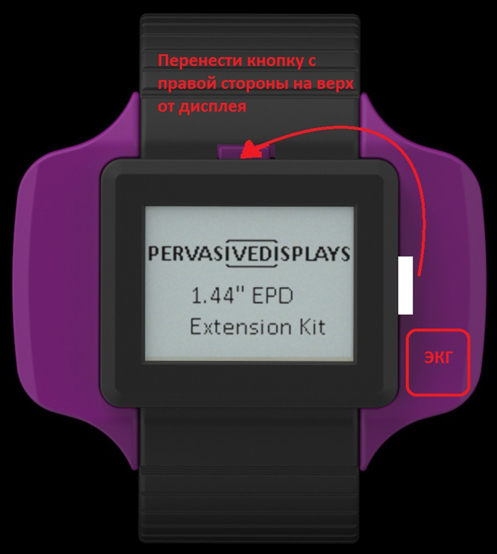 Сложности разработки медицинского браслета в России