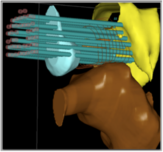 Выступление Кена Голдберга на RCC 2013 Выступление Кена Голдберга на RCC 2013