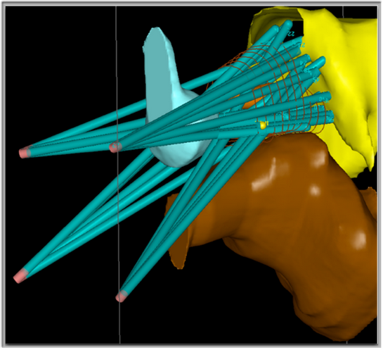 Выступление Кена Голдберга на RCC 2013 Выступление Кена Голдберга на RCC 2013
