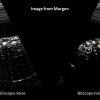 Самодельный сканер УЗИ получил первые изображения