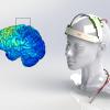 Электростимуляция мозга улучшает умственные способности, креативность и память здоровых людей