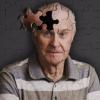 Ученые научились приостанавливать болезнь Альцгеймера