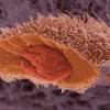 Нобелевскую премию по физиологии и медицине присудили за исследование «самопоедания» клеток