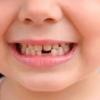 Ученые рассказали, зачем человеку нужны молочные зубы