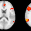 фМРТ определяет ложь лучше полиграфа