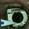 История операций по коррекции зрения: сравнение рисков и побочных эффектов